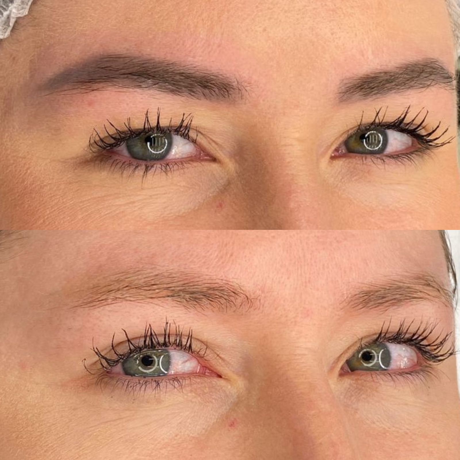Procedimento Laser Repair
